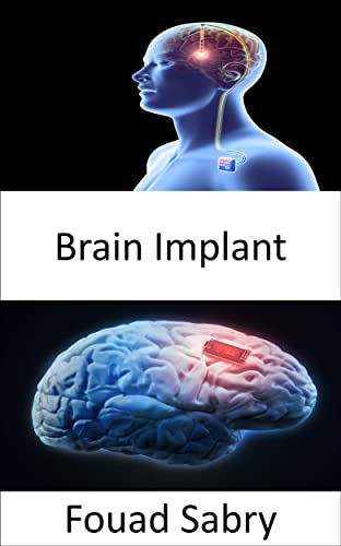 Brain Implant The research that supports Neuralink, Elon Musk's proposed brain chip (Emerging Technologies in Medical Book )