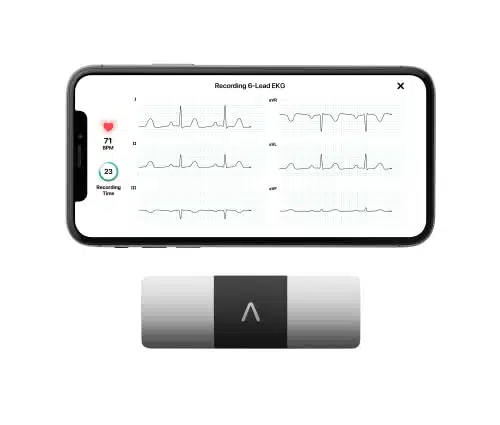 KardiaMobile Lead Personal EKG Monitor â Six Views of The Heart â Detects AFib and Irregular Arrhythmias â Instant Results in Seconds â Works with Most Smartphones   FSAHSA Eligible